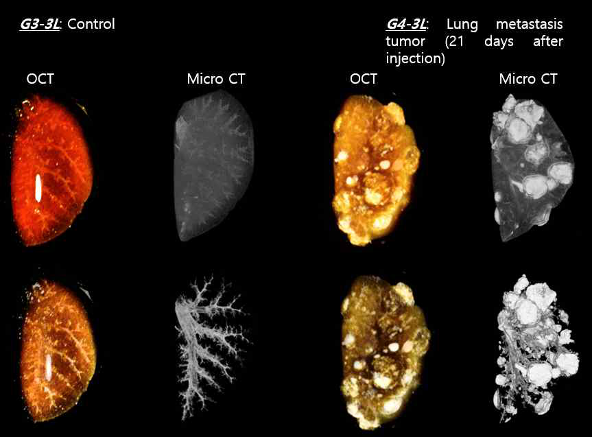 Comparison of 3D images from OCT and Micro-CT