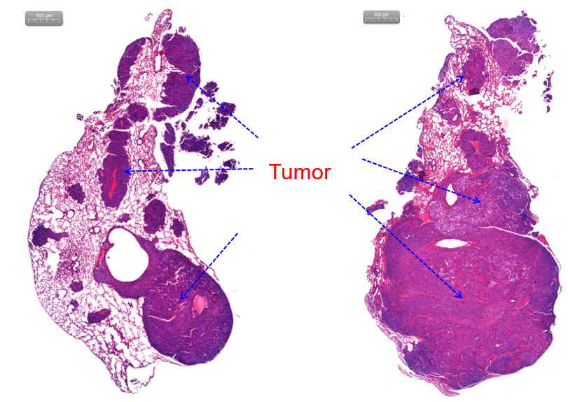 Comparison of tumor size in serial section of lung from mouse