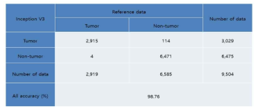 Confusion matrix of lung metastatic tumor