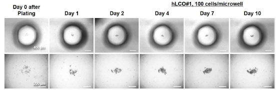 Human Liver Cancer Organoid (hLCO) Formation in Microwell of the PDMS-based Microwell Fluidic Array (hLCO#1, 100 cells/microwell)