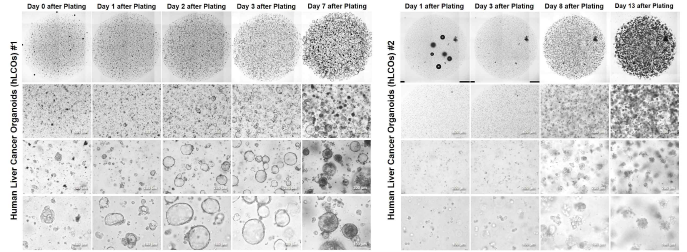 Matrigel을 이용한 다른 종류의 인체 간암 오가노이드의 배양기간 확인