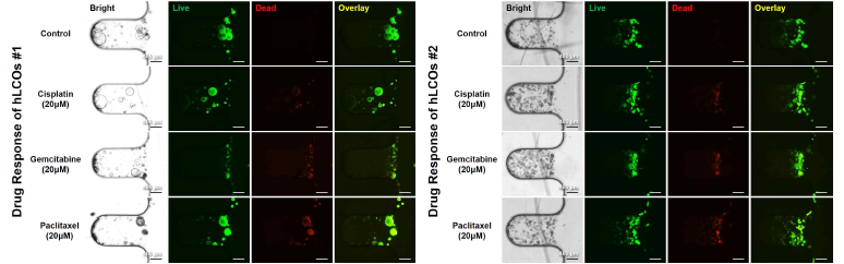 시제품 미세유체칩 내 배양된 두 종류의 간암 오가노이드의 항암 약물 반응 테스트
