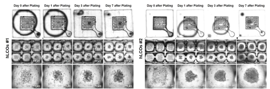 미세유체 CLF microwell array 챔버 내 다른 성격의 간암 오가노이드 배양 및 성장 확인
