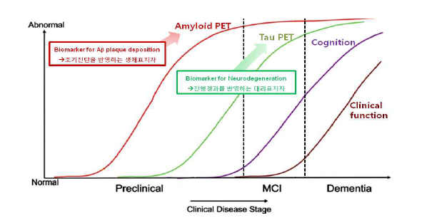 알츠하이머 병 진행단계에 따른 바이오마커