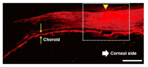 마이크로니들 기반 망막 내 후보 인자 조절 시스템(European Journal of Pharmaceutics and Biopharmaceutics 2018)