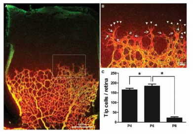 생쥐 정상 망막혈관 발달 모델에서 망막혈관 끝세포(tip cell)의 정량적 분석(Current Eye Research 2017)