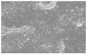 돼지 유래 신장세포 초대배양 현미경 사진, 다각형의 세포들이 섬을 이루고 길쭉한 모양의 세포들이 끈처럼 이어져 둘러싸는 형태로 배양된다