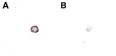 조직내교잡법을 이용한 돼지 써코바이러스3형 염색 사진, A.돼지 신장 유래 초대배양세포, 세포질에 강한 갈색 시그널이 보인다. B.돼지 신장 유래 PK-15세포주, 어떤 시그널도 보이지 않는다