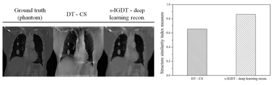 기존 재구성 기술 및 기 개발한 기술을 동시 적용한 s-IGDT 시스템의 (좌) 결과 영상, (우) 정량적 평가 결과