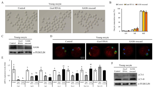 어린 난자의 Gas6 발현 회복 기반 미토콘드리아 분포 및 mitophagy 분석