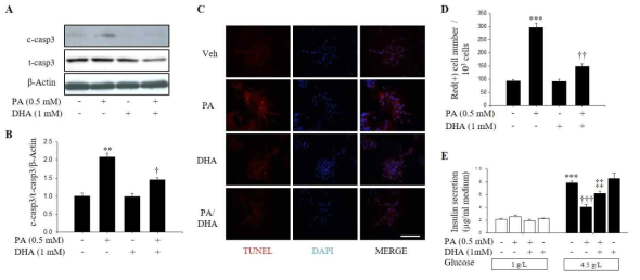 Protective effect of DHA against lipotoxicity in pancreatic β-cell. (A, B) Cleaved/total-caspase3 was measured by western blotting assay and the ratio to β-actin was described. (C, D) Apoptosis of pancreatic β-cell was labeled with Red spots by TUNEL assay. The number of apoptotic cells was statistically described. (E) Released insulin was extracted from culture media and measured by mouse insulin ELISA kit. PA: Palmitate, DHA: Docohexaenoic acid