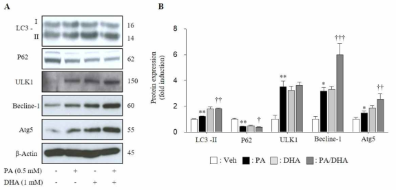 DHA treatment facilitates autophagy in insulin-secreting MIN cells. (A) Autophagy-related factors including LC3-II, P62, ULK1, Beclin1 and Atg5 was examinded by western blotting analysis. (B) Expression level of autophagy-related factors was described as ratio to β-actin