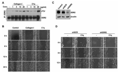 C1q-DDR2 결합에 의한 wound healing