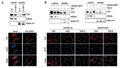 TAZ localization is regulated by acetylation