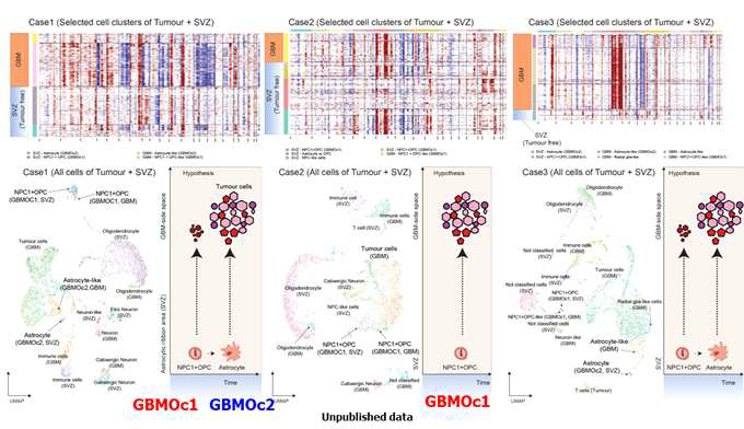 3명의 GBM tumor와 SVZ의 paired snRNAseq을 통하여 SVZ에 7gain 혹은 10loss가 있는 세포를 찾아 내었고 이는 GBMOc1과 GBMOc2임