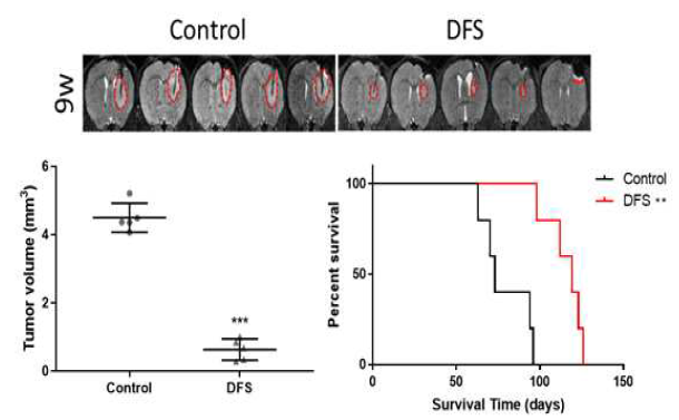 환자 유래 종양구를 이용한 orthotopic mouse model. DFS를 처리한 환자 유래 종양구가 그렇지 않은 종양구보다 종양을 작게 생성하였으며, 전체 생존율도 높았음