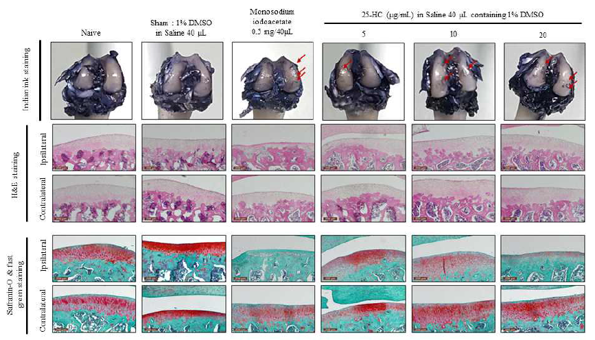 25-HC의 실험동물의 무릎 관절강 내 주입 후 관절퇴행성에 대한 조직학적 분석. 상단, Indian ink staining; 중간, H 하단, Safranin-O & fast green staining