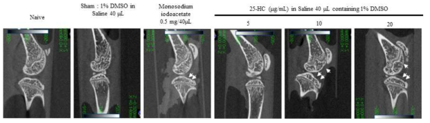 micro-CT를 활용한 방사선계측학적 관절퇴행성 분석