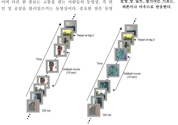 실험 중 공감과 연민을 불러일으키는 동영상(좌), 혹은 추상적인 프랙탈 동영상이 제시된다