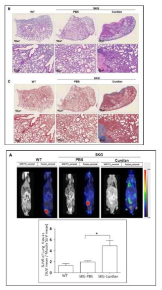 PET-MRI scan and Lung Histology