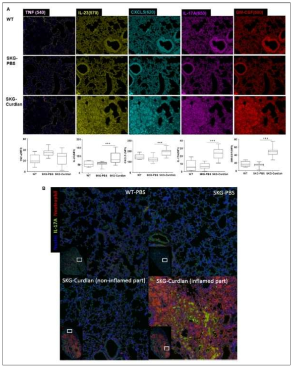 Multiplexed immunofluorescent images of lung tissues