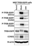 A) TFEB-EGFP를 발현하는 세포에서 CHX를 처리하여 얻은 lysate에서 TFEB의 Serine 122, 142, 211의 인산화 정도를 각 phospho-specific 항체로 관찰함. 또한 cyclin D1 (CCND1) 항체를 이용하여 CCND1의 변화를 Western blot으로 관찰함