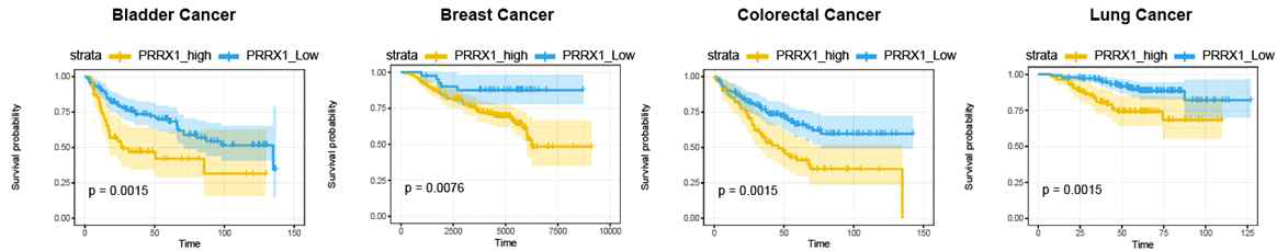 Prrx1의 과발현이 다양한 암종에서 나쁜 예후와 관련이 있음을 확인함