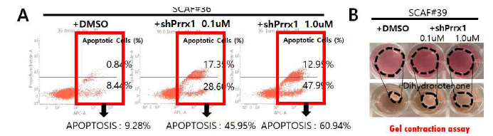 위암에서 유래한 암연관 섬유아세포에서 Prrx1의 발현을 감소시켰을 때 apoptosis가 크게 증가하고 섬유아 세포의 gel contraction능력도 감소함