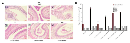 Nasal-associated lymphoid tissue histology analysis (H&E, PAS staining) in NALT of OVA-induced asthma plus allergic rhinitis mouse model