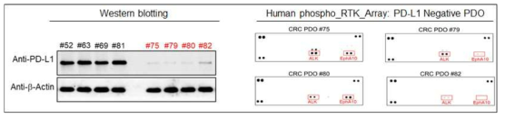 대장암 PDO 단백질 활용 PD-L1 발현 및 RTK 관련 단백질 활성 확인