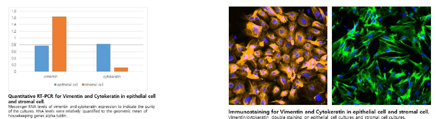 자궁내막 상피세포 및 기질세포의 vimentin/cytokeratin RT-PCR 및 면역염색