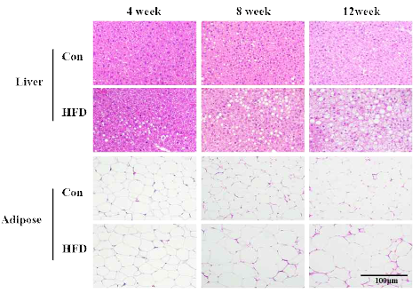 Representative images of histological observations using hematoxylin-eosin staining in the hepatic and adipose tissues from normal diet or high-fat diet mice