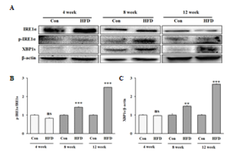 Expression of IRE-1α and XBP1s in the liver during high-fat diet in mice. Representative western blots for total protein and phosphorylate expression of IRE-1α and XBP1s (A); densitometric analysis of p-IRE-1 α/IRE-1α (B) and XBP1s/β-actin (C). All data are expressed as mean ± SD. Con versus HFD, ns = not significant, * p < 0.05, ** p < 0.01, *** p < 0.001