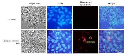 Red fluorescence-labeled adipose tissue-derived exosome uptake in AML12 cells. Representative fluorescence microscope images show the distribution of adipose tissue-derived exosomes, as indicated by the PKH-26 red fluorescent dye, while cell nuclei were stained with DAPI (blue) (Scale bar = 50 μm)
