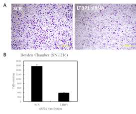위암세포의 이동에 있어 LTBP1의 역할