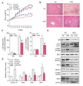 SREBP-1c 결핍마우스에서 고지방식이에 의해 조절되는 Autophagy 관련 인자들의 변화