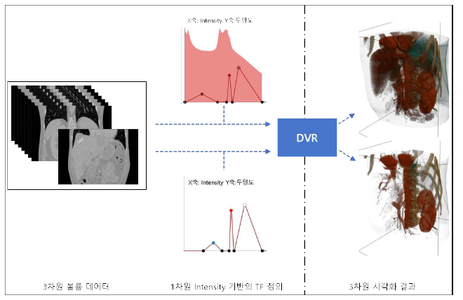 3차원 의료 영상 볼륨 데이터와 함께, 두 개의 각각 다른 TF과 반영된 DVR 시각화 결과