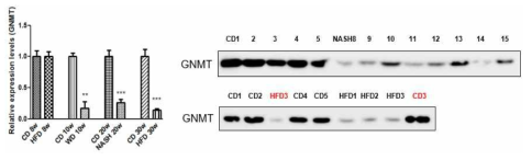western diet, HFD diet 30주 등 NASH 유발 모델에서의 GNMT 감소