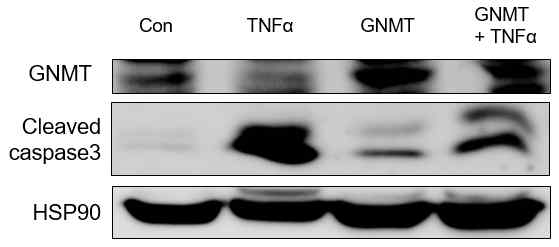 GNMT transfection이 간세포 사멸에 미치는 영향