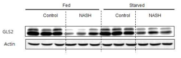 NASH 간조직에서 GLS2가 감소함을 확인하였음