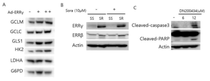 ERRγ과발현과 ERRγ inverse agonist에 의한 효과