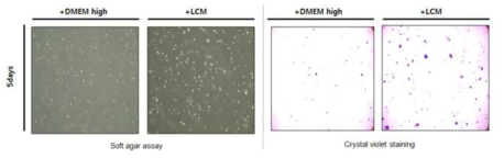 간성상세포 CM 처리 후 colony formation