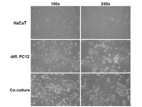 HaCaT와 differentiated PC12를 이용한 공생 배양