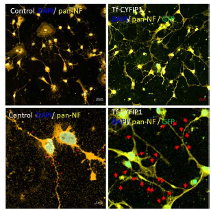 CYFIP1-GFP를 과발현하고 dendritic spine 숫자와 크기 측정