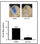 Type 1 allergy response in WT and Axl KO mouse