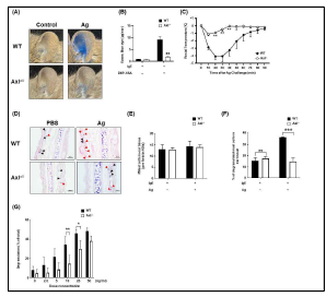 Comparison of in vitro and in vivo IgE-/Antigenmediated mast cell activation between WT and AXL KO mice