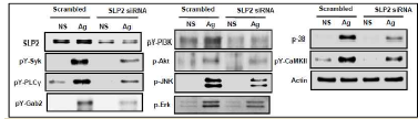 Regulatory effect of SLP2 on antigen-induced mast cell activation signaling