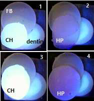The CMOS images of a three-layer situation. FB, 1-mm thick flowable resin, was over the tooth and under a conventional composite resin of two different thicknesses (1,2: 0.2 mm, 3,4: 1 mm). CH was unaffected by the underlying FB and tooth. On the other hand, HP was affected at first (0.2 mm thick), then unaffected as they came thick (1 mm thick)