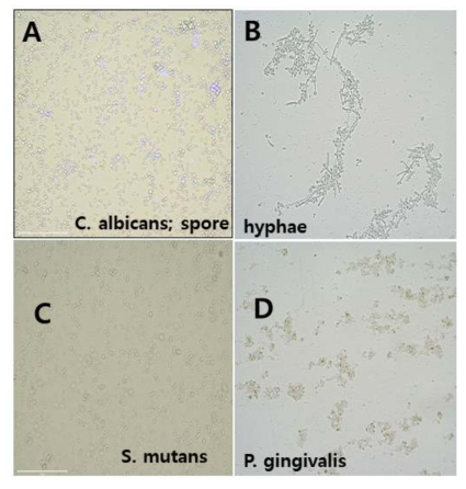 Candida albicans (A: spore; B: hyphae), S. mutans (C), P. gingivalis (D)의 형광현미경 영상 (×400배; 백색광에서 관찰)