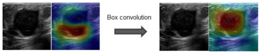 Box convolution 적용 전 (GAP만 이용)과 적용 후